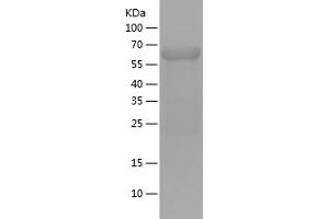 Western Blotting (WB) image for Inhibitor of kappa Light Polypeptide Gene Enhancer in B-Cells, Kinase gamma (IKBKG) (AA 120-419) protein (His-IF2DI Tag) (ABIN7123432) (IKBKG Protein (AA 120-419) (His-IF2DI Tag))