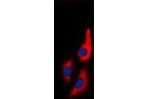 Immunofluorescent analysis of MYL9 staining in Jurkat cells. (MYL9 antibody  (N-Term))