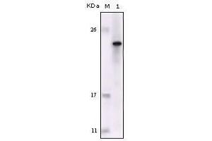 Western Blot showing FES antibody used against truncated FES recombinant protein. (FES antibody)