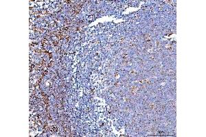 anti-Pyrophosphatase 2 (PPA2) (AA 33-334) antibody