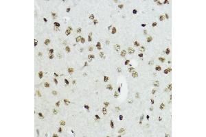 Immunohistochemistry of paraffin-embedded mouse brain using Acetyl-Histone H3-K27 antibody (ABIN7267670) at dilution of 1:200 (40x lens). (Histone 3 antibody  (H3K27))