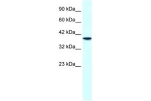 Western Blotting (WB) image for anti-H6 Family Homeobox 1 (HMX1) antibody (ABIN2460518) (HMX1 antibody)