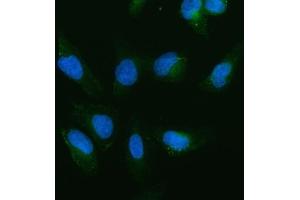 IF analysis of cIAP1/BIRC2 using anti-cIAP1/BIRC2 antibody (ABIN5693185). (BIRC2 antibody  (AA 320-570))