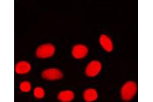 Immunofluorescent analysis of ADA2A staining in MCF7 cells. (TADA2L antibody  (Center))