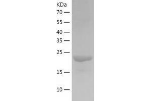 Western Blotting (WB) image for Glutathione S-Transferase omega 2 (GSTO2) (AA 1-243) protein (His tag) (ABIN7288817) (GSTO2 Protein (AA 1-243) (His tag))