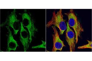 ICC/IF Image HSD11B1 antibody detects HSD11B1 protein at cytoplasm by immunofluorescent analysis. (HSD11B1 antibody  (C-Term))