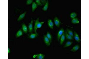 Immunofluorescent analysis of A549 cells using ABIN7174731 at dilution of 1:100 and Alexa Fluor 488-congugated AffiniPure Goat Anti-Rabbit IgG(H+L) (PARP11 antibody  (AA 1-245))