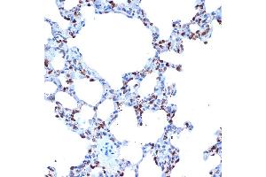 Immunohistochemistry of paraffin-embedded rat lung using  Rabbit mAb (ABIN7265434) at dilution of 1:100 (40x lens). (ADAM15 antibody)