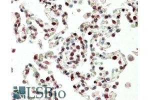 ABIN1781955 (5µg/ml) staining of paraffin embedded Human Lung. (HOXB6 antibody  (Internal Region))