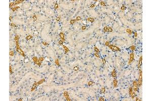 ABIN6263517 and ABIN6266843 at 1/100 staining Rat kidney tissue by IHC-P. (NAA15 antibody  (Internal Region))
