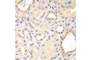 Immunohistochemistry of paraffin-embedded human kidney using SPIN2B antibody (ABIN5975141) at dilution of 1/100 (40x lens). (Spindlin 2B antibody)