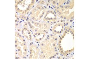 Immunohistochemistry of paraffin-embedded human kidney using SPIN2B antibody (ABIN5975141) at dilution of 1/100 (40x lens).