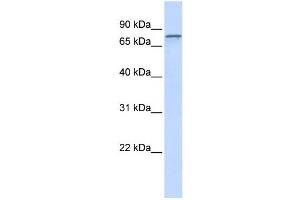 Western Blotting (WB) image for anti-ADAM Metallopeptidase Domain 15 (ADAM15) antibody (ABIN2459014) (ADAM15 antibody)