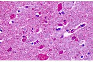 CELSR2 antibody  (N-Term)