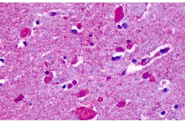 CELSR2 antibody  (N-Term)