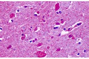 Anti-CELSR2 antibody IHC staining of human brain, cortex, cerebellum.