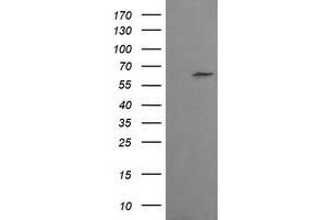 Image no. 1 for anti-Chaperonin Containing TCP1, Subunit 8 (Theta)-Like 2 (CCT8L2) antibody (ABIN1497481) (CCT8L2 antibody)