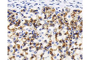 Immunohistochemistry analysis of paraffin-embedded Rat stomach using Catenin beta Monoclonal Antibody at dilution of 1:200. (beta Catenin antibody)