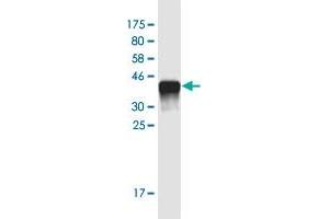 Western Blot detection against Immunogen (36. (NUT (AA 1033-1132) antibody)