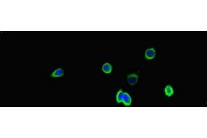 Immunofluorescent analysis of HepG2 cells using ABIN7170309 at dilution of 1:100 and Alexa Fluor 488-congugated AffiniPure Goat Anti-Rabbit IgG(H+L) (SSTR2 antibody  (AA 304-369))