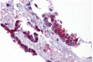 Human Lung: Formalin-Fixed, Paraffin-Embedded (FFPE)