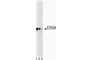 Western blot analysis of Drp1 on a HCT-8 cell lysate (Human colorectal adenocarcinoma, ATCC CCL-244).