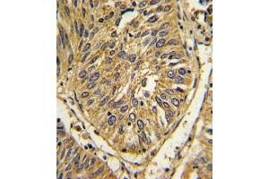 Immunohistochemistry (Paraffin-embedded Sections) (IHC (p)) image for anti-Fibroblast Growth Factor Receptor 2 (FGFR2) antibody (ABIN391968)