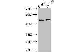 Western Blot Positive WB detected in: HepG2 whole cell lysate, Jurkat whole cell lysate All lanes: RUNX1T1 antibody at 2.