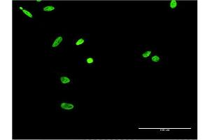 Immunofluorescence of monoclonal antibody to EWSR1 on HeLa cell. (EWSR1 antibody  (AA 358-453))