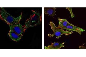Immunofluorescence analysis of NTERA-2 cells (left) and U251 (right) cells using KLHL13 mouse mAb (green). (KLHL13 antibody)