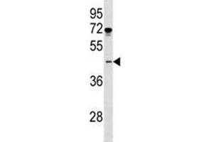 ISL1 antibody western blot analysis in MDA-MB231 lysate. (ISL1 antibody  (AA 156-185))