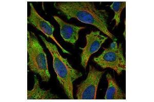 ICC/IF Image Confocal immunofluorescence analysis (Olympus FV10i) of methanol-fixed HeLa, using Villin, antibody (Green) at 1:500 dilution. (Villin 1 antibody  (N-Term))