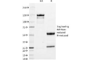 SDS-PAGE Analysis Purified IgA Mouse Monoclonal Antibody (IA761). (IGHA1 & IGHA2 antibody (CF®488A))