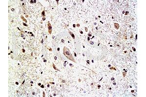 Formalin-fixed and paraffin embedded: rat spinal cord tissue labeled with Anti-Neurofascin Polyclonal Antibody, Unconjugated (ABIN727325) at 1:200, followed by conjugation to the secondary antibody and DAB staining (NFASC antibody  (AA 501-650))
