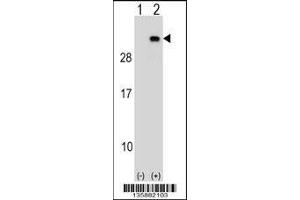 Western blot analysis of PGRMC2 using rabbit polyclonal PGRMC2 Antibody using 293 cell lysates (2 ug/lane) either nontransfected (Lane 1) or transiently transfected (Lane 2) with the PGRMC2 gene.