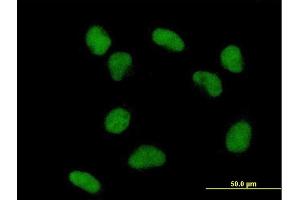 Immunofluorescence of purified MaxPab antibody to TDG on HeLa cell. (TDG antibody  (AA 1-410))