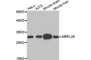 Western Blotting (WB) image for anti-Mitochondrial Ribosomal Protein L28 (MRPL28) antibody (ABIN1876936) (MRPL28 antibody)