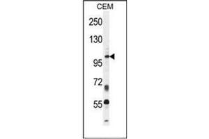 Western blot analysis of INPP5B / 5PTase 2 Antibody (C-term) in CEM cell line lysates (35ug/lane). (INPP5B antibody  (C-Term))