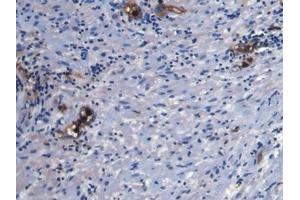 Detection of S100A8 in Human Prostate Tissue using Monoclonal Antibody to S100 Calcium Binding Protein A8 (S100A8)