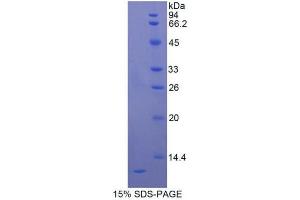 SDS-PAGE (SDS) image for Interleukin 8 (IL8) ELISA Kit (ABIN6574136)