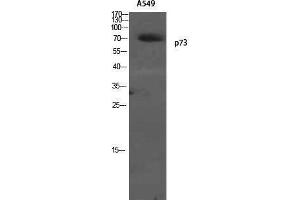Western Blotting (WB) image for anti-Tumor Protein P73 (TP73) (Tyr220) antibody (ABIN3176745) (Tumor Protein p73 antibody  (Tyr220))