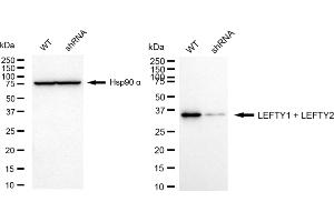 Western blotting analysis using LEFTY1 + LEFTY2 antibody (ABIN7799246).