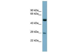 RAB27A antibody used at 1 ug/ml to detect target protein. (RAB27A antibody  (Middle Region))