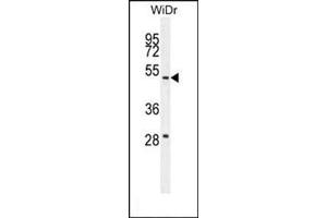 Western blot analysis in WiDr cell line lysates (35 µg/lane) using RT4I1 Antibody (C-term) Cat. (RTN4IP1 antibody  (C-Term))