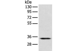 Western blot analysis of Jurkat cell using CD1D Polyclonal Antibody at dilution of 1:300 (CD1d antibody)