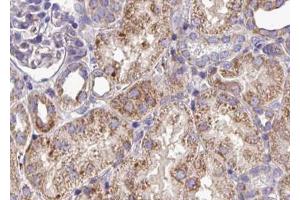 ABIN6268802 at 1/100 staining human kidney tissue sections by IHC-P. (EPH Receptor A3 antibody  (C-Term))
