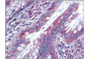 Human Colon: Formalin-Fixed, Paraffin-Embedded (FFPE) (MUC13 antibody  (C-Term))
