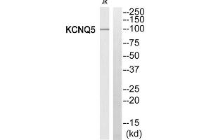 Western blot analysis of extracts from Jurkat cells, using KCNQ5 antibody.