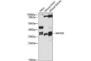 Western blot analysis of extracts of various cell lines, using MB antibody (ABIN6128286, ABIN6143576, ABIN6143577 and ABIN6215296) at 1:3000 dilution. (MAT2B antibody  (AA 1-334))