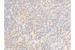 ABIN6267271 at 1/100 staining mouse spleen tissue sections by IHC-P. (c-MYC antibody  (pSer62))